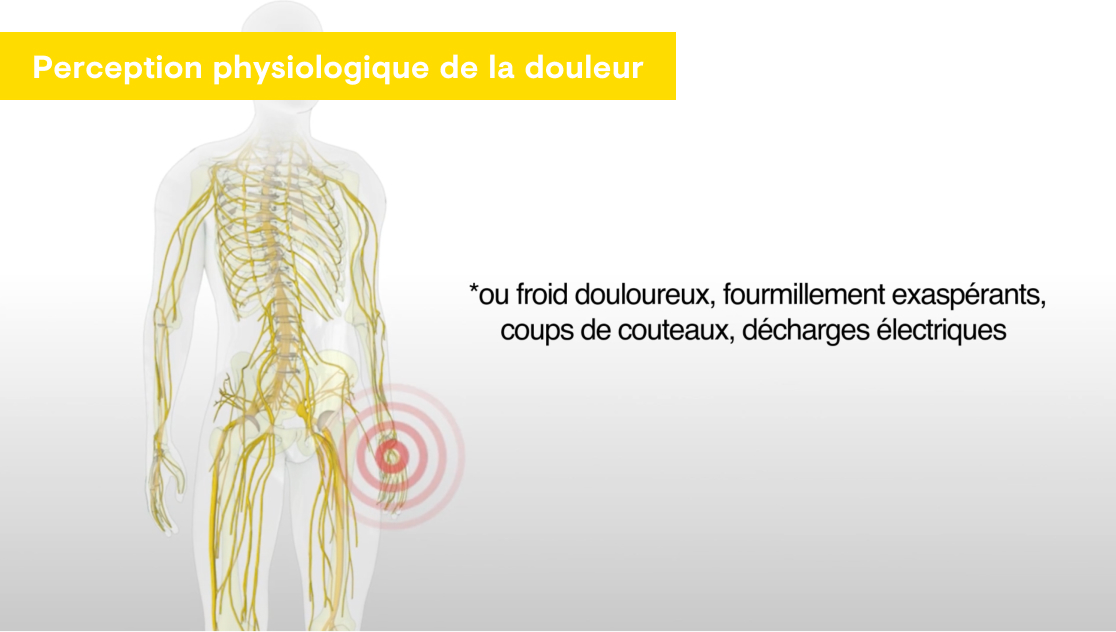 Perception physiologique et douleur neuropathique